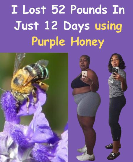 Purple Honey For Weight Loss - I lost 52 pounds in just 12 days Using Purple Honey - HoneyBurn Review
