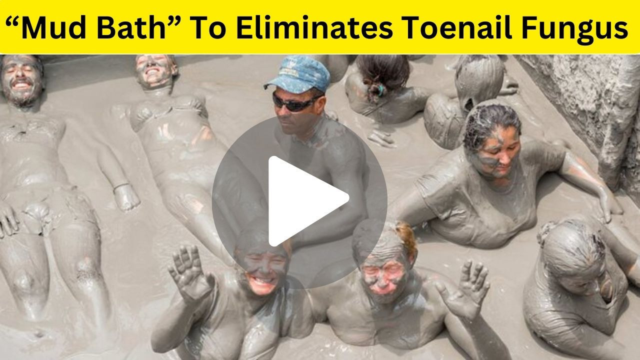 KeraBiotics Review - How Does “Mud Bath Ritual” Eliminates Toenail Fungus?